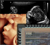 File:High Definition Ultrasound.jpg